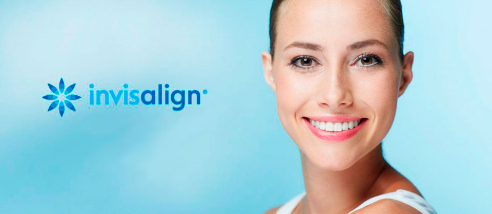 Sistema Invisalign