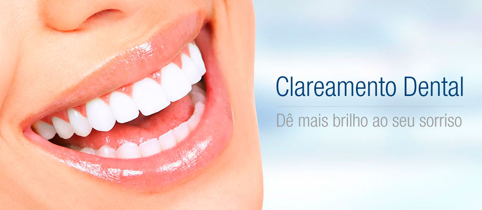 Clareamento Dental