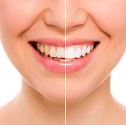 Dentística