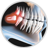 Cirurgia Buco Maxilo Facial