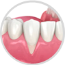 Plástica Periodontal