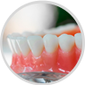 Prótese Dental