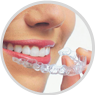 Sistema Invisalign